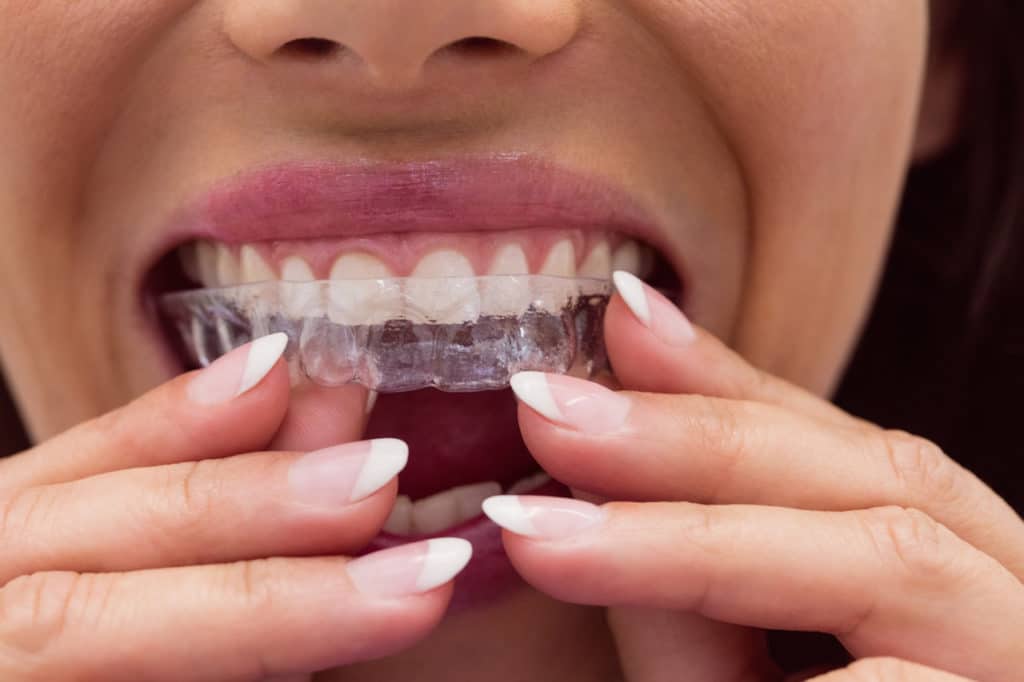 orthodontiste sion